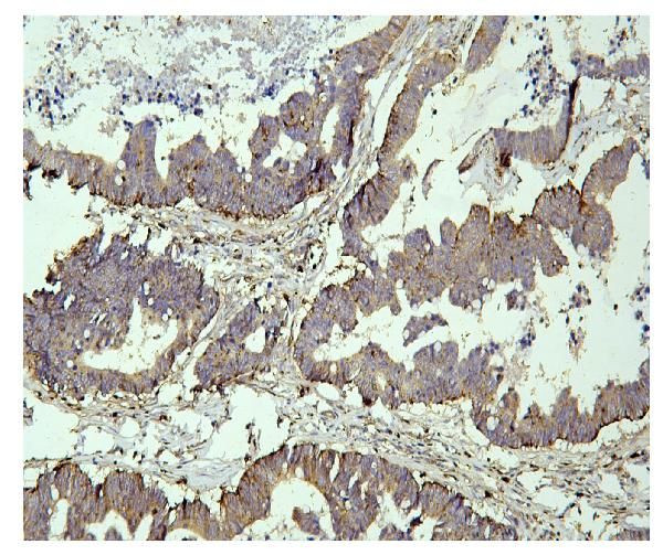 PPT1 Antibody in Immunohistochemistry (Paraffin) (IHC (P))