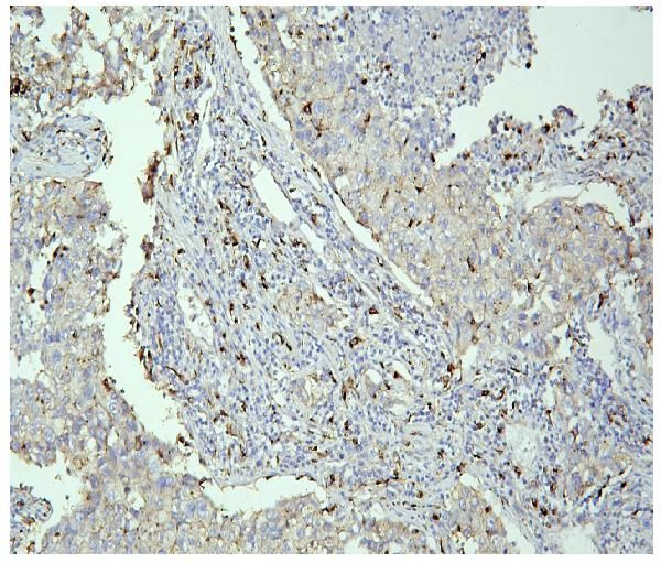 PPT1 Antibody in Immunohistochemistry (Paraffin) (IHC (P))