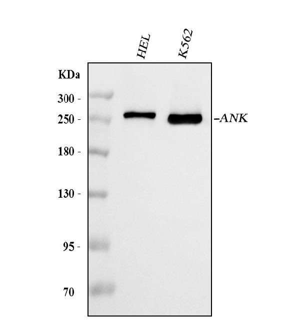 Ankyrin 1 Antibody in Western Blot (WB)