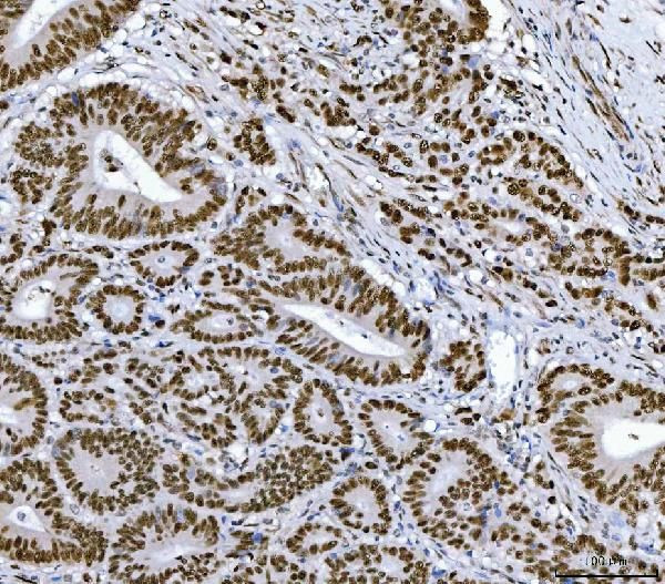 RCC1 Antibody in Immunohistochemistry (Paraffin) (IHC (P))