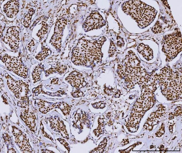 RCC1 Antibody in Immunohistochemistry (Paraffin) (IHC (P))