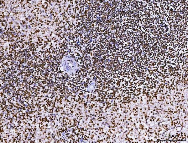 RCC1 Antibody in Immunohistochemistry (Paraffin) (IHC (P))