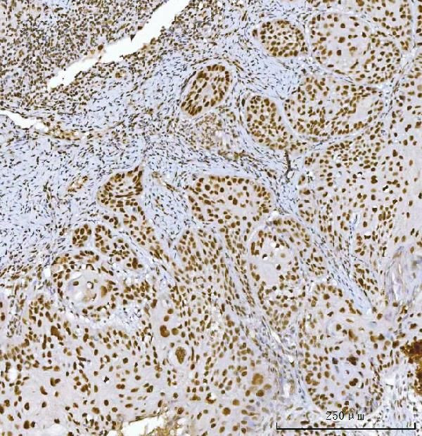 RCC1 Antibody in Immunohistochemistry (Paraffin) (IHC (P))