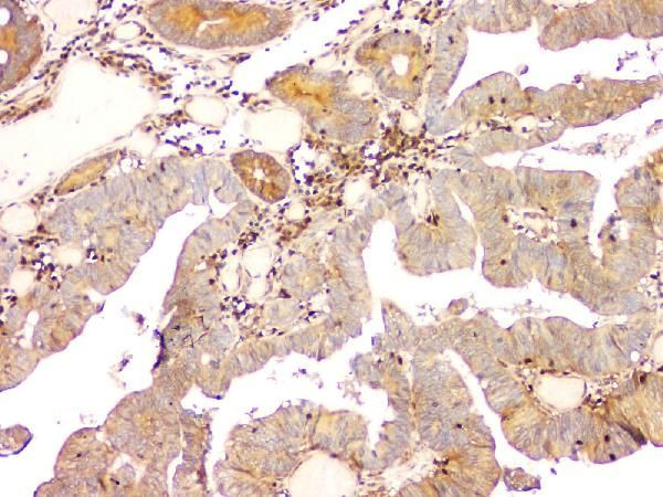 AIP Antibody in Immunohistochemistry (Paraffin) (IHC (P))