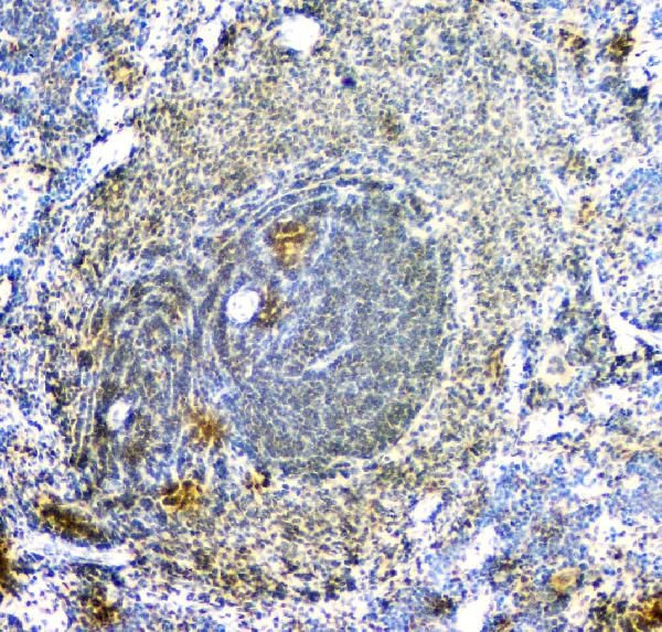 AIP Antibody in Immunohistochemistry (Paraffin) (IHC (P))