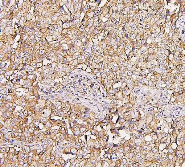 NMI Antibody in Immunohistochemistry (Paraffin) (IHC (P))