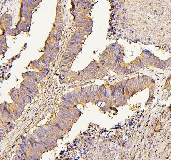 NMI Antibody in Immunohistochemistry (Paraffin) (IHC (P))