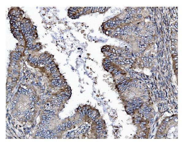 GSDMD Antibody in Immunohistochemistry (Paraffin) (IHC (P))