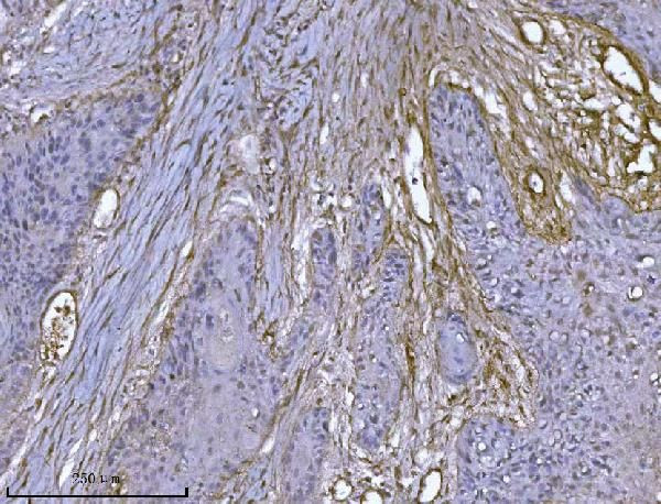 ILK Antibody in Immunohistochemistry (Paraffin) (IHC (P))