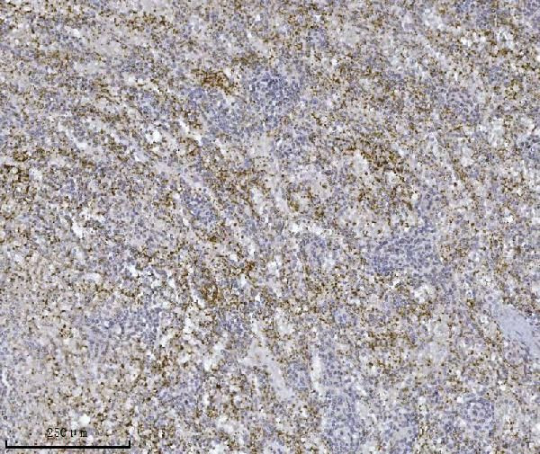 ILK Antibody in Immunohistochemistry (Paraffin) (IHC (P))