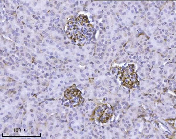 ILK Antibody in Immunohistochemistry (Paraffin) (IHC (P))