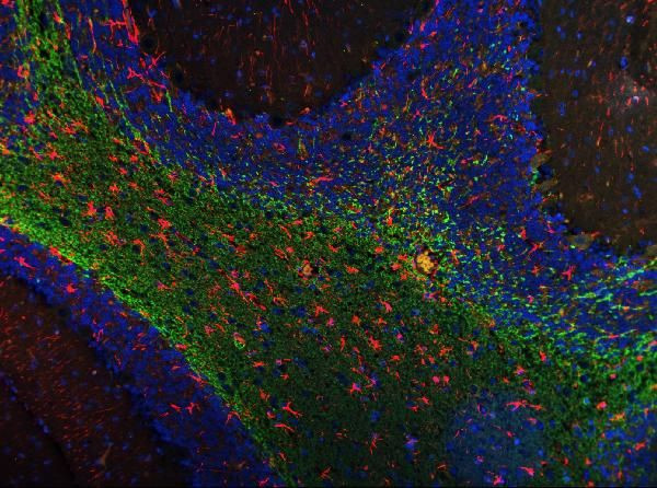 MAG Antibody in Immunohistochemistry (Paraffin) (IHC (P))