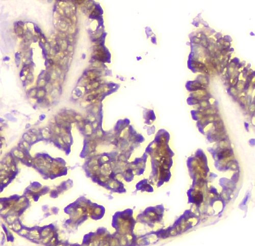 Cyclophilin B Antibody in Immunohistochemistry (Paraffin) (IHC (P))