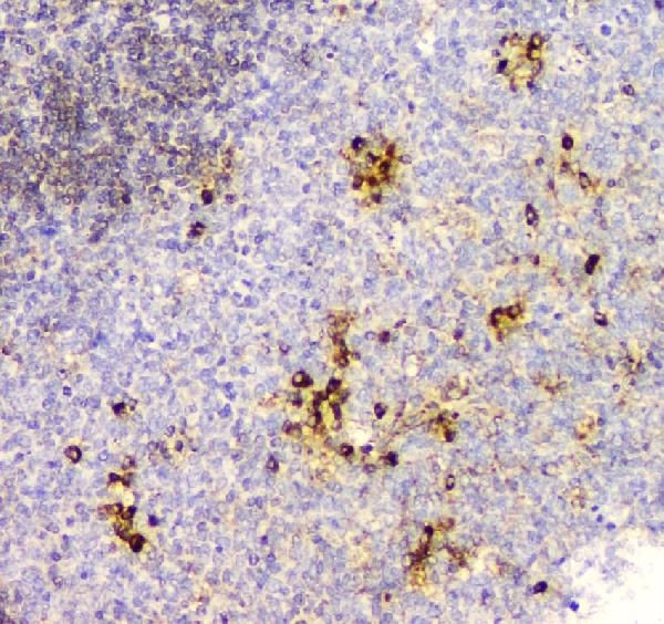 Cyclophilin B Antibody in Immunohistochemistry (Paraffin) (IHC (P))