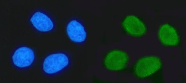 TRIM24 Antibody in Immunocytochemistry (ICC/IF)