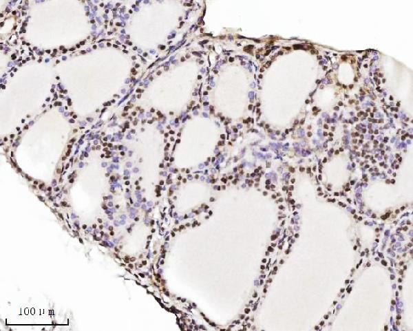 TRIM24 Antibody in Immunohistochemistry (Paraffin) (IHC (P))