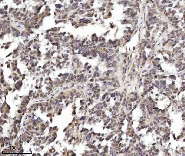 TRIM24 Antibody in Immunohistochemistry (Paraffin) (IHC (P))