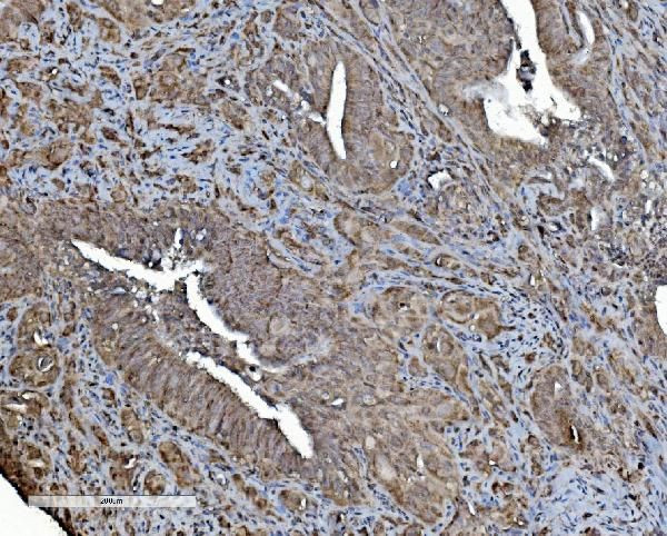 REA Antibody in Immunohistochemistry (Paraffin) (IHC (P))