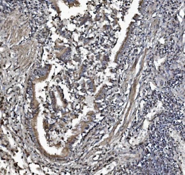 REA Antibody in Immunohistochemistry (Paraffin) (IHC (P))