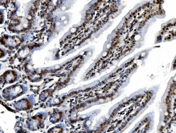 REA Antibody in Immunohistochemistry (Paraffin) (IHC (P))