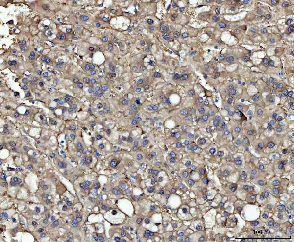 ME1 Antibody in Immunohistochemistry (Paraffin) (IHC (P))