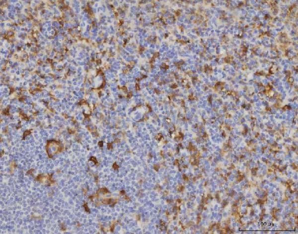 ME1 Antibody in Immunohistochemistry (Paraffin) (IHC (P))