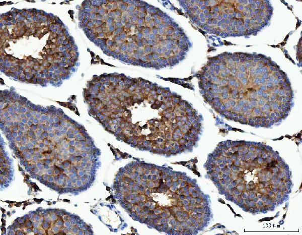 ME1 Antibody in Immunohistochemistry (Paraffin) (IHC (P))