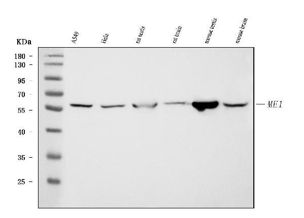 ME1 Antibody in Western Blot (WB)