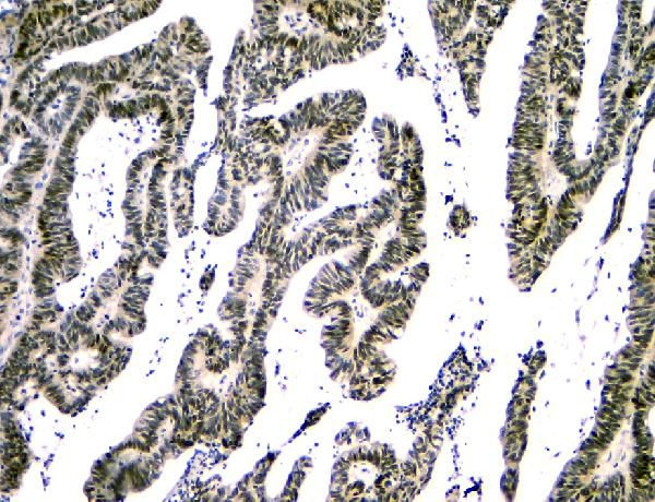 NFIA Antibody in Immunohistochemistry (Paraffin) (IHC (P))