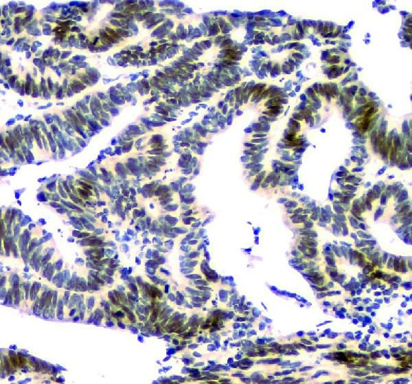 NFIA Antibody in Immunohistochemistry (Paraffin) (IHC (P))