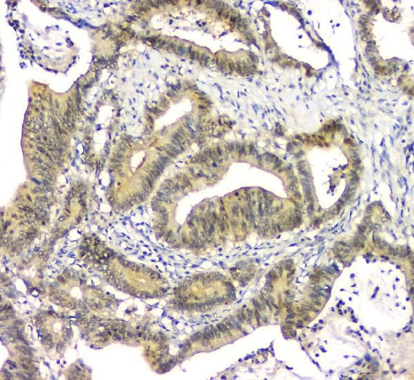 eIF6 Antibody in Immunohistochemistry (Paraffin) (IHC (P))