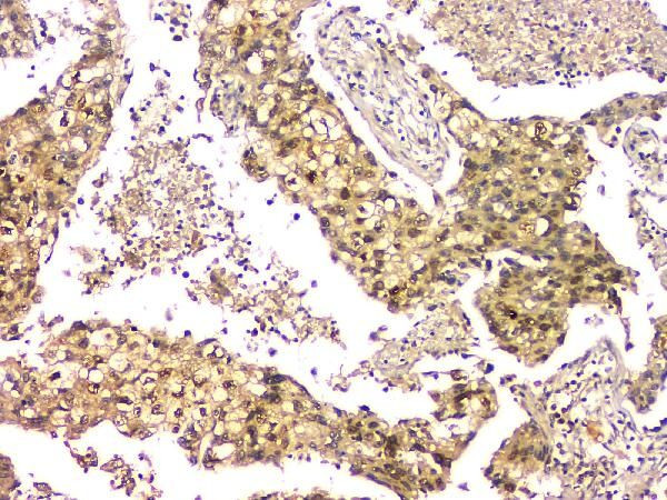 eIF6 Antibody in Immunohistochemistry (Paraffin) (IHC (P))