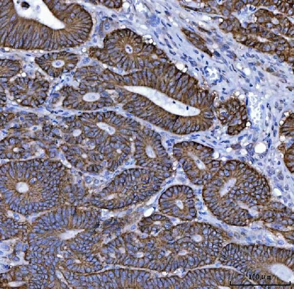 NKCC1 Antibody in Immunohistochemistry (Paraffin) (IHC (P))