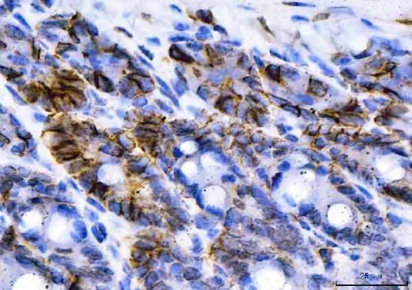 NKCC1 Antibody in Immunohistochemistry (Paraffin) (IHC (P))