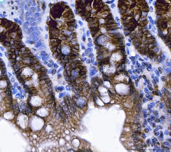 NKCC1 Antibody in Immunohistochemistry (Paraffin) (IHC (P))