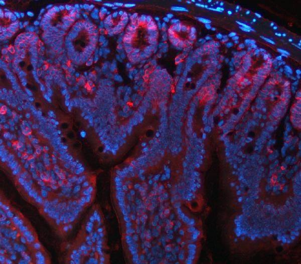 NKCC1 Antibody in Immunohistochemistry (Paraffin) (IHC (P))