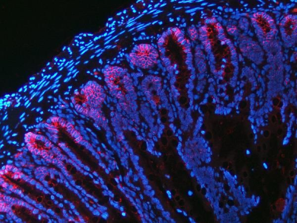 NKCC1 Antibody in Immunohistochemistry (Paraffin) (IHC (P))