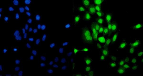 MCM5 Antibody in Immunocytochemistry (ICC/IF)