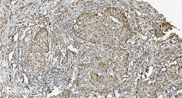 MCM5 Antibody in Immunohistochemistry (Paraffin) (IHC (P))