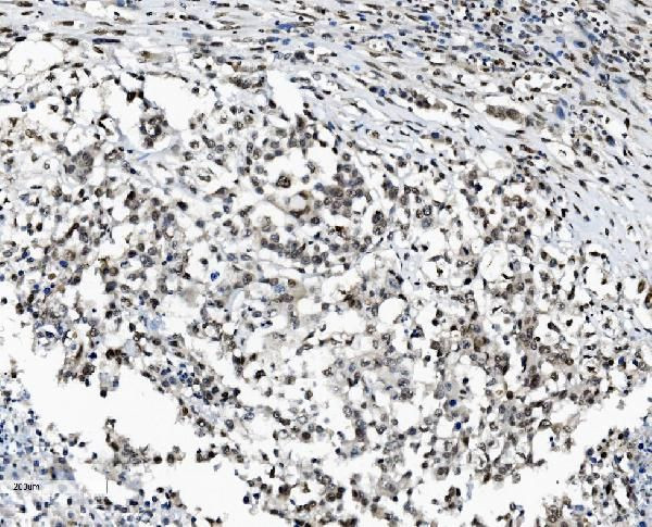 DDX1 Antibody in Immunohistochemistry (Paraffin) (IHC (P))