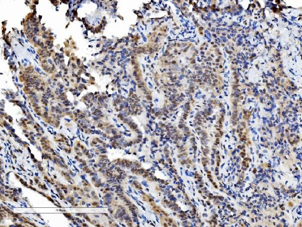 DDX1 Antibody in Immunohistochemistry (Paraffin) (IHC (P))