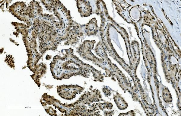 DDX1 Antibody in Immunohistochemistry (Paraffin) (IHC (P))