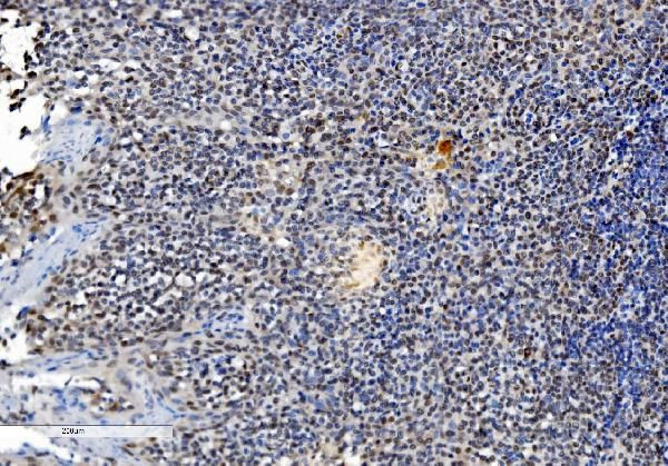 DDX1 Antibody in Immunohistochemistry (Paraffin) (IHC (P))