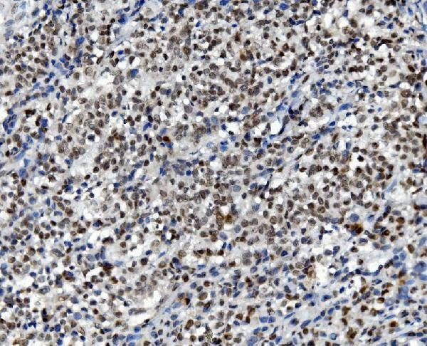 DDX1 Antibody in Immunohistochemistry (Paraffin) (IHC (P))