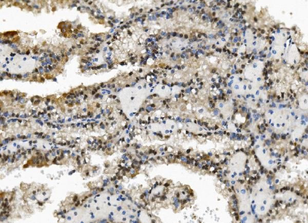 DDX1 Antibody in Immunohistochemistry (Paraffin) (IHC (P))