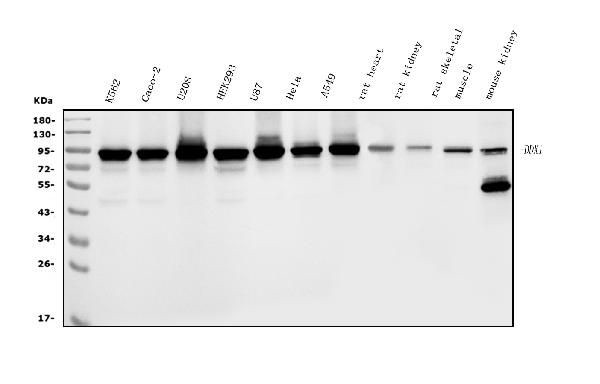 DDX1 Antibody in Western Blot (WB)