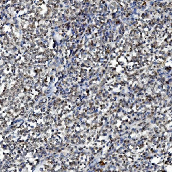 DDX1 Antibody in Immunohistochemistry (Paraffin) (IHC (P))