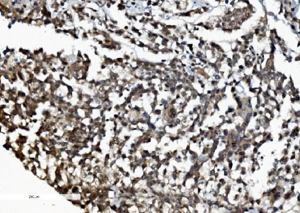 DDX1 Antibody in Immunohistochemistry (Paraffin) (IHC (P))