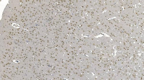 DDX1 Antibody in Immunohistochemistry (Paraffin) (IHC (P))