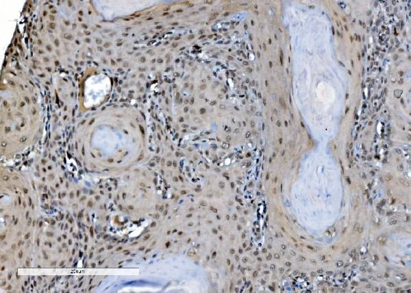 DDX1 Antibody in Immunohistochemistry (Paraffin) (IHC (P))